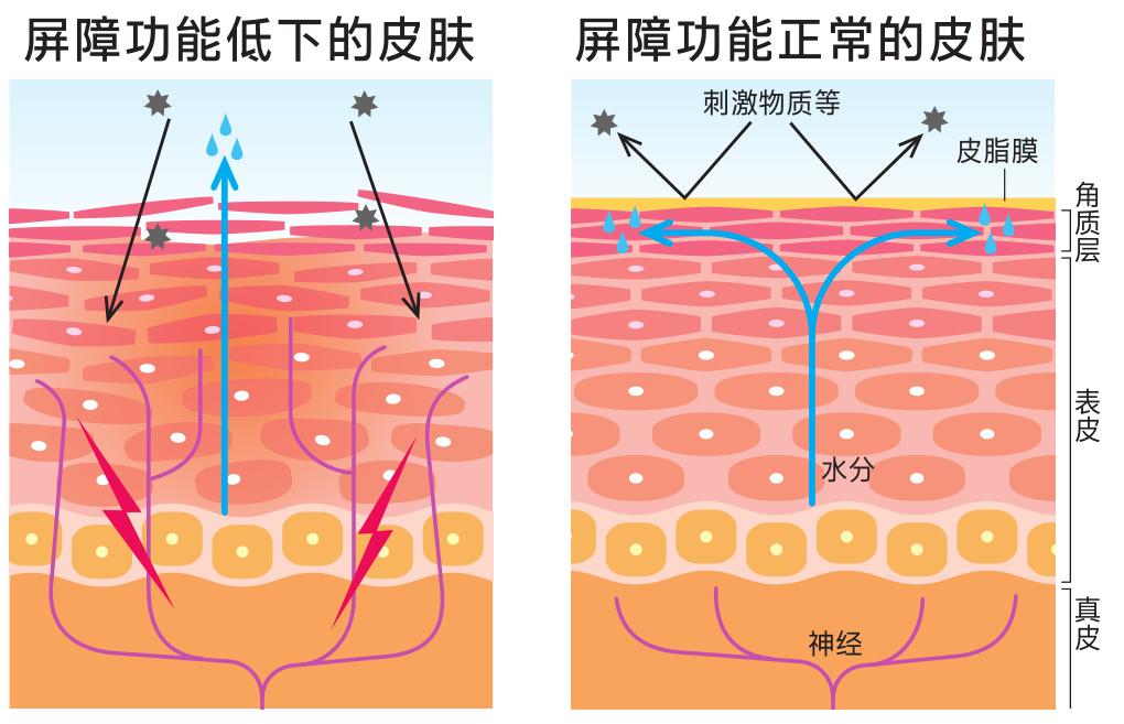 修复敏感肌抗衰老,扎心用什么方法可以缓解