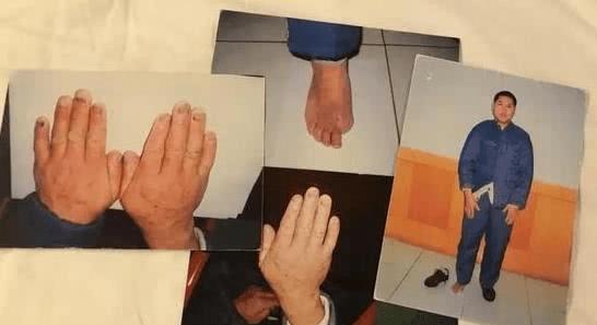 刘忠林获最高赔偿,蒙冤者刘忠林的赔偿