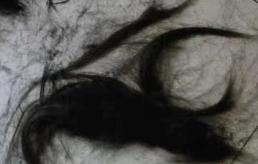 贵州农村发现鬼剃头,走近科学鬼剃头