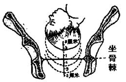孕妈妈怎么判断胎位是正的,胎儿屁股在右侧是什么胎位