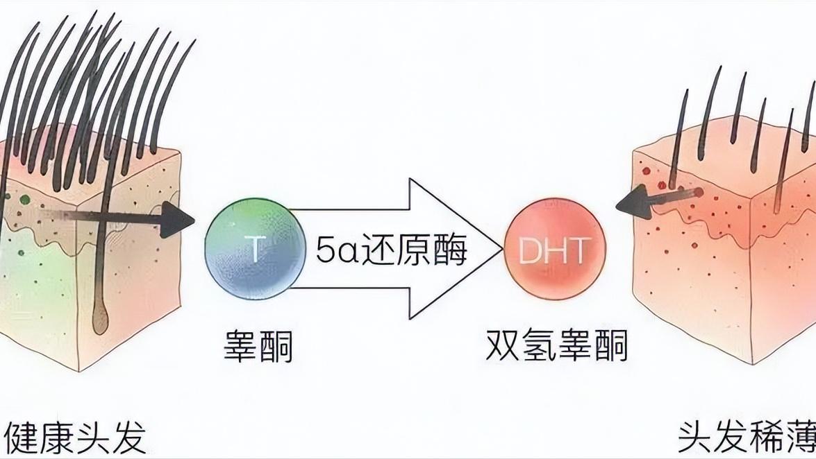 斑秃7年了用米诺地尔有效果吗 (40岁以后用米诺地尔还有效吗)