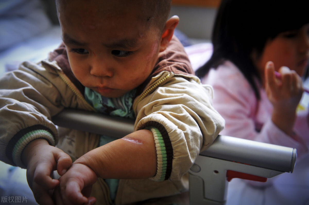 世界一级致癌物槟榔,一级致癌物槟榔有多恐怖