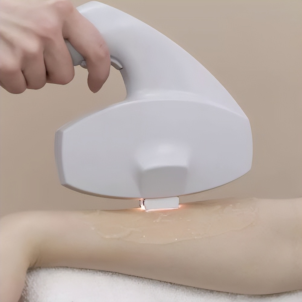 二极管激光脱毛服务市场调研-主要企业、市场规模、发展趋势