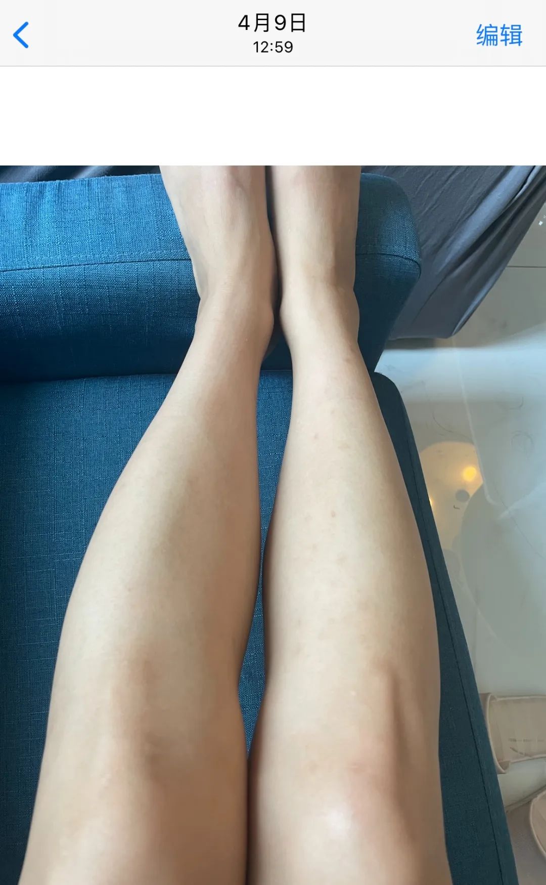 暑假一个月黄黑皮如何美白,天生黑皮的美白项目