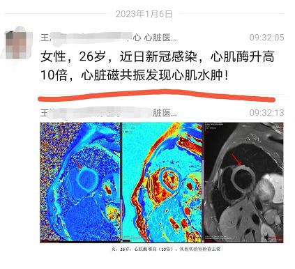 女子阳后确诊心肌炎,阳了后心肌炎6个征兆