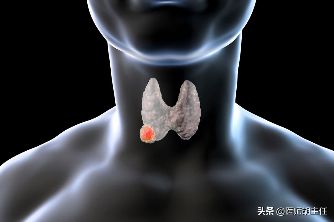 体检查出甲状腺结节到底要不要,体检查出甲状腺结节需要重视吗