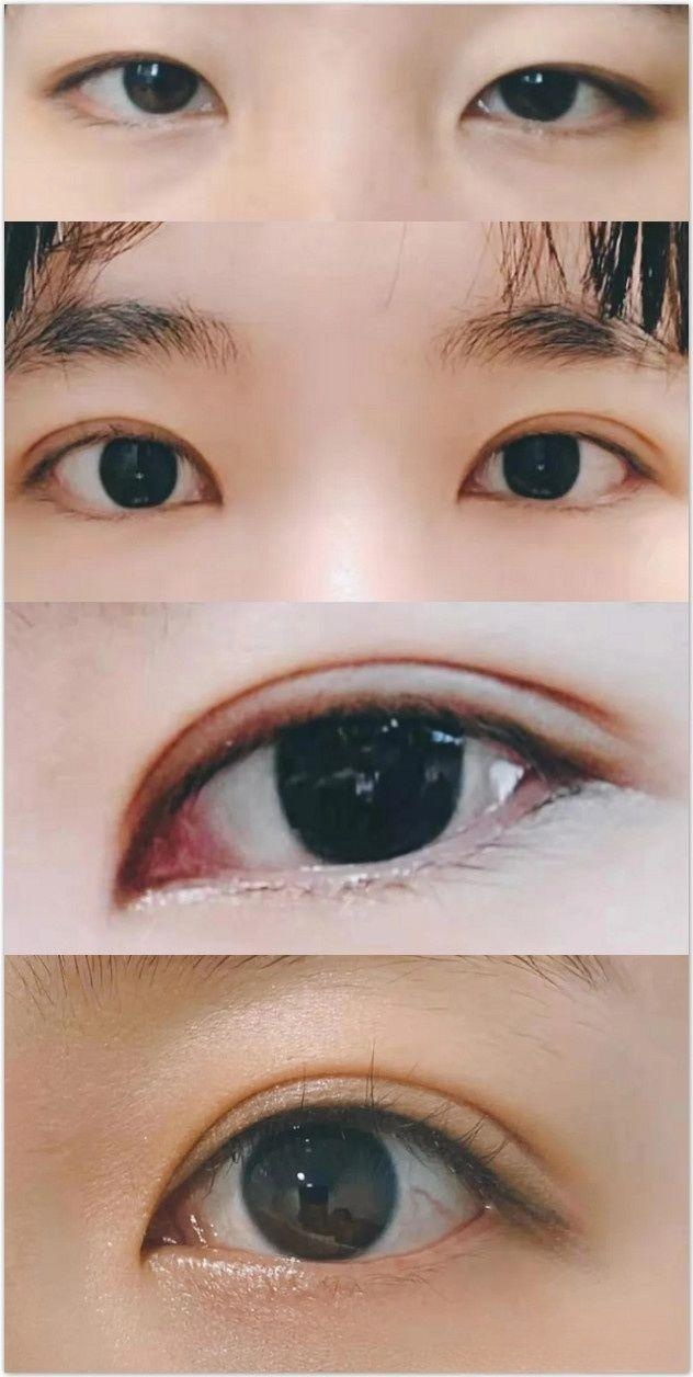 上海做双眼皮哪个医院好,上海哪个医院做双眼皮最好