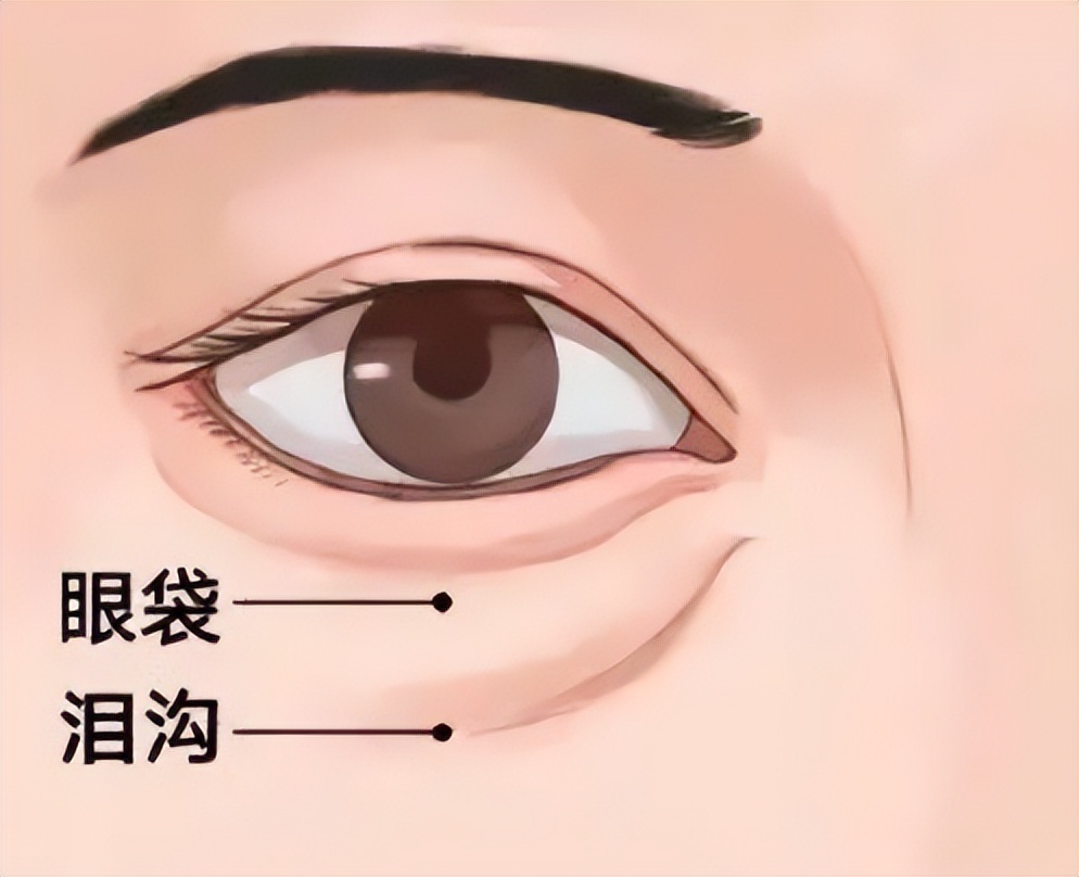 黑眼圈眼袋泪沟重怎么遮瑕,眼霜推荐去黑眼圈眼袋泪沟