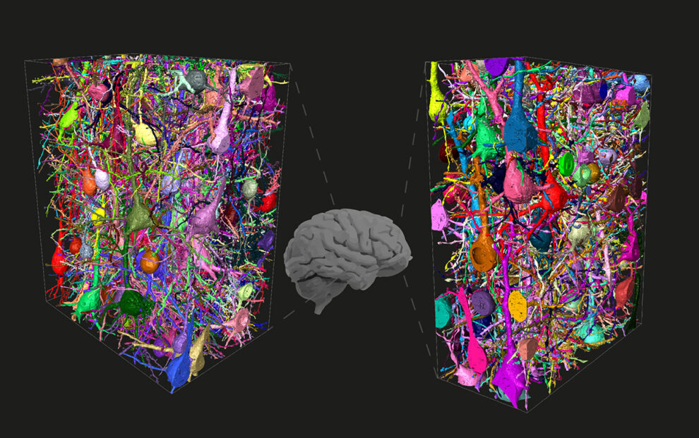 人类独有的大脑系统,人类独特的大脑结构