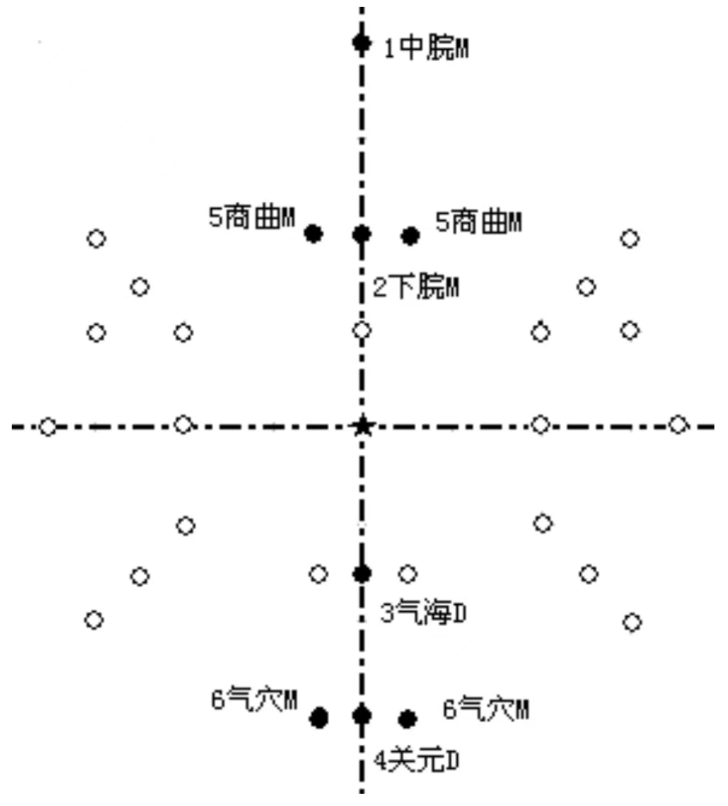 腹针疗法,腹针疗法最新处方大全