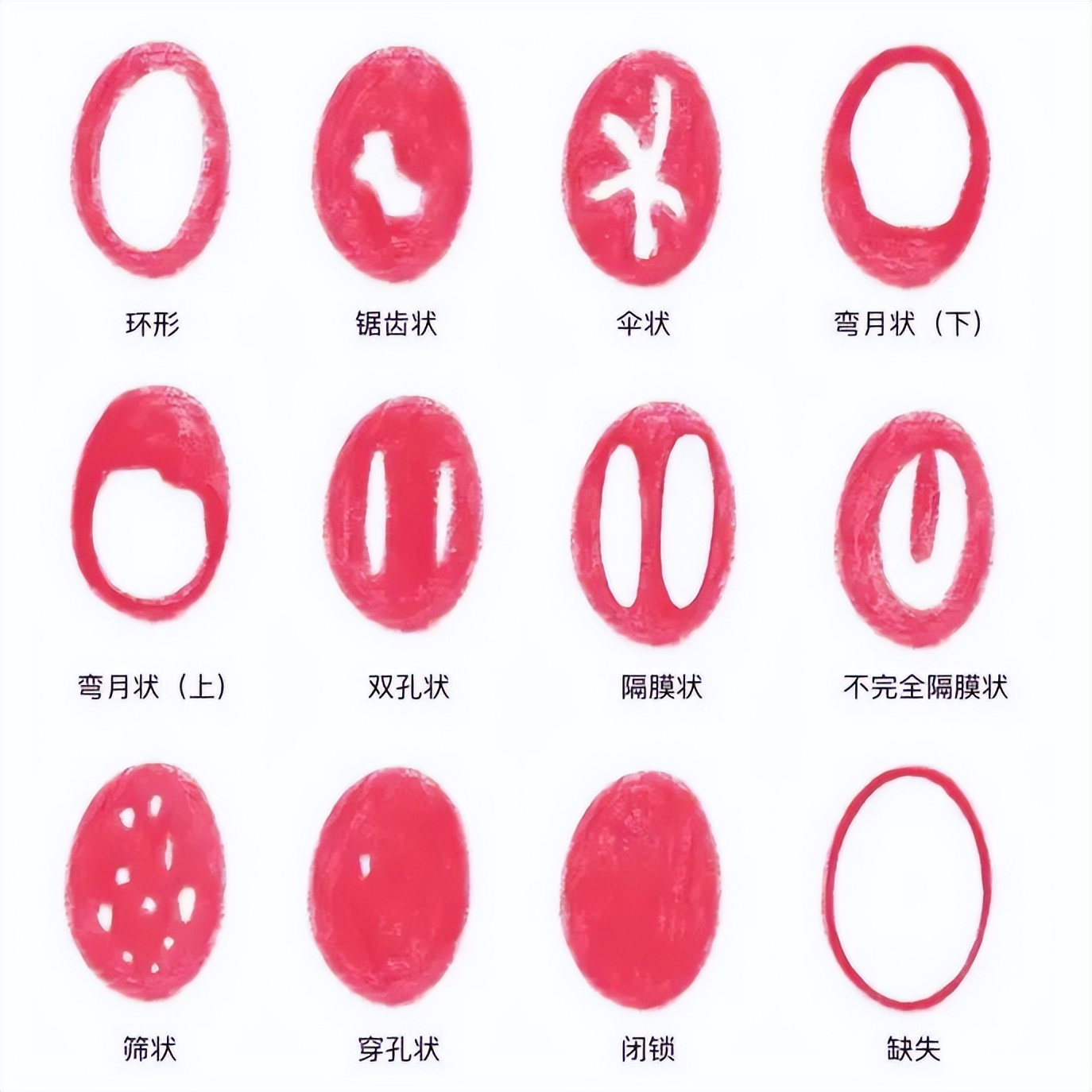 “*处破**”一定会流血？处女膜还能修复？很多人都想错了！