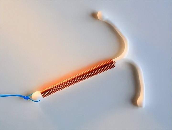 女人放节育环对身体伤害大吗,节育环超过年限对女性的危害