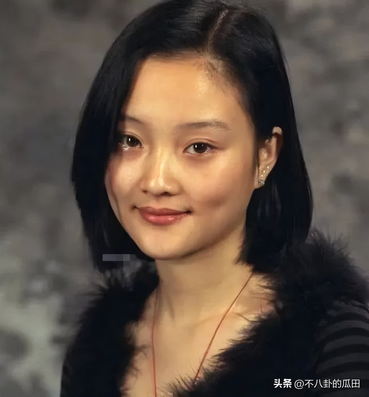 蔡徐坤下巴太尖惹争议图片,蔡徐坤下巴是假体吗