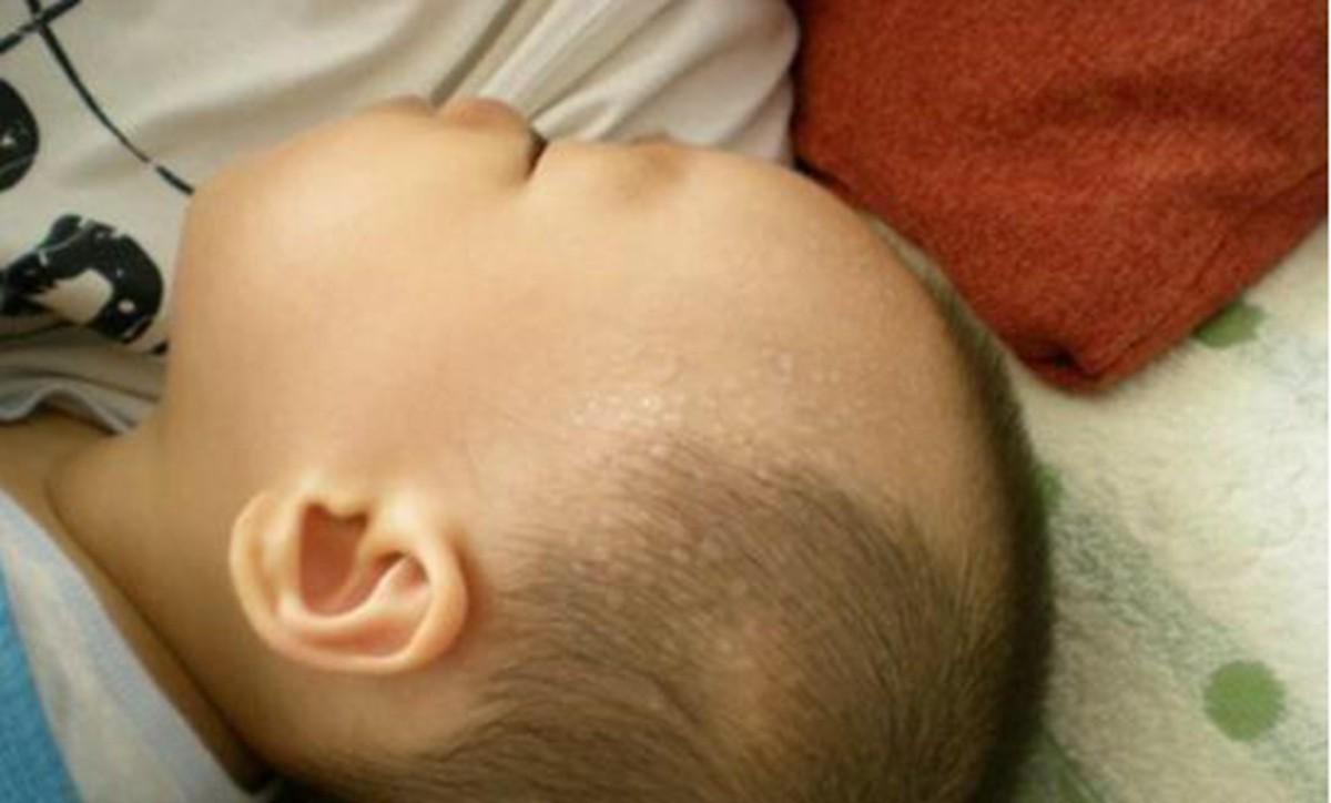 天气热宝宝睡觉容易出汗怎么办,热天宝宝睡觉头老是出汗