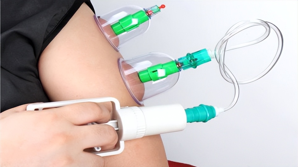 拔火罐益处和弊端,拔火罐有什么好处跟坏处呀