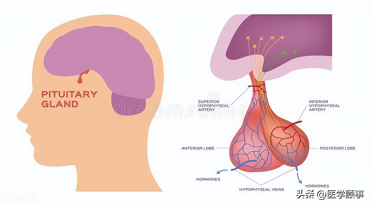 促性腺激素瘤可以治愈吗,促肾上腺素型垂体瘤怎么治疗