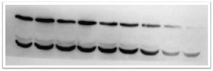 WB实验条带问题？原因分析和解决方法都在这里