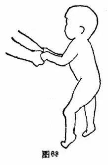 脑瘫儿童康复训练走路,脑瘫患者步行分解训练的6个步骤