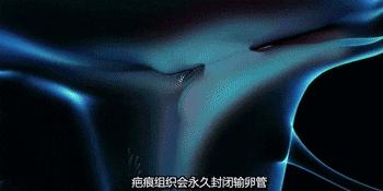 输卵管一边堵了一边切了怎么办,输卵管明明通了为啥又堵了