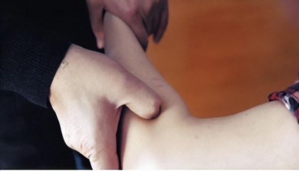 桡骨远端骨折的护理方法,手腕桡骨远端骨折后的恢复过程