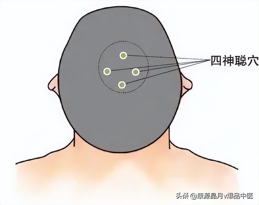 中医精华之人体特效穴,经外奇穴69个疑难杂症图解