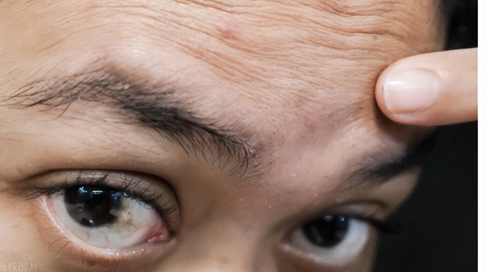 痘痘反复长痘印消不掉怎么办,3到4年青春痘反反复复用什么药好