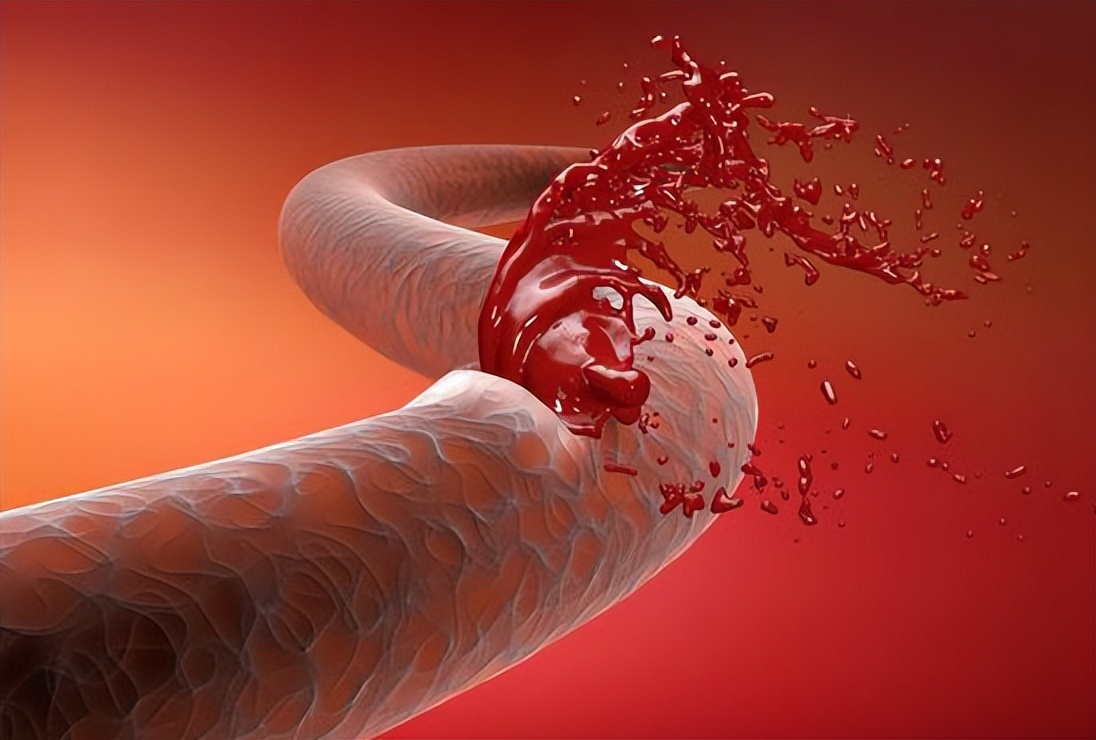 介入手术后发烧正常吗,介入治疗发烧多久才正常