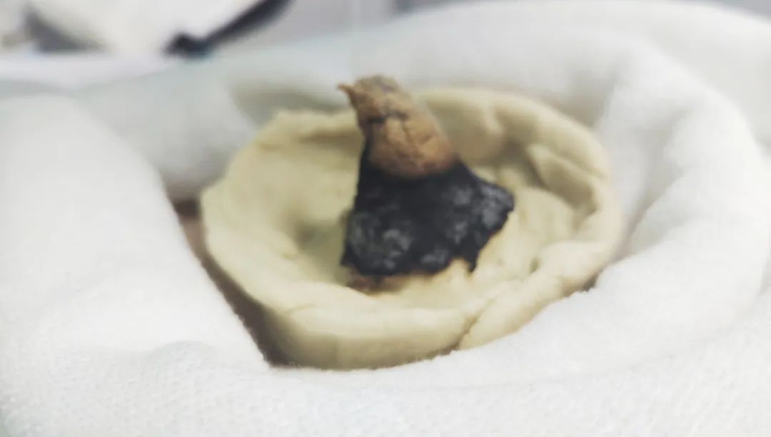 艾草飘香呵护健康——*安泰**市中心医院中医妇科开展艾灸治疗受欢迎