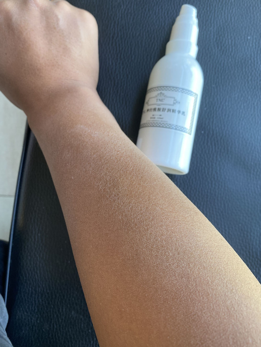 身上老是洗不干净是怎么回事,洗完澡皮肤干痒起白皮屑怎么回事