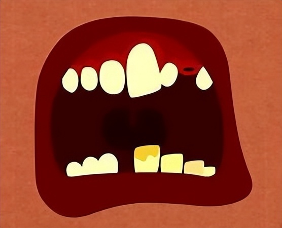 牙周病到底是什么样子的,牙周病是怎样出现的你知道吗