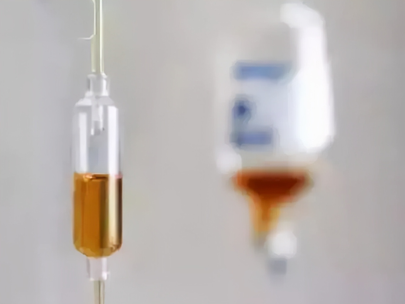 发现动脉硬化还能活多久,发现血管斑块是不是就是脑梗了