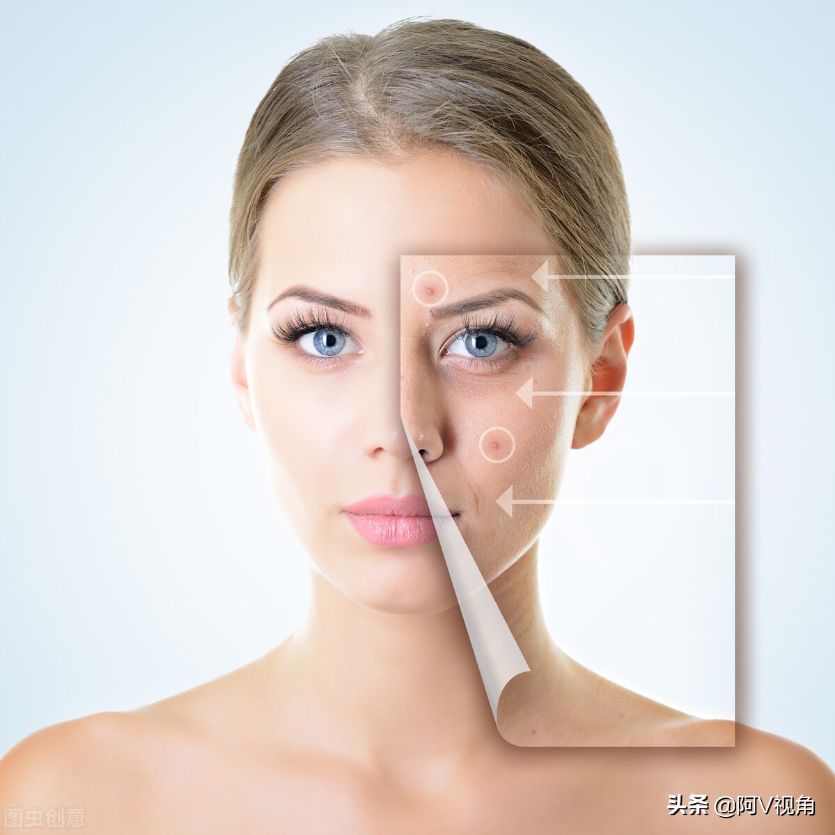 脸上长痘痘了怎么消除最快方法,脸上长痘痘怎么办快速解决小妙招