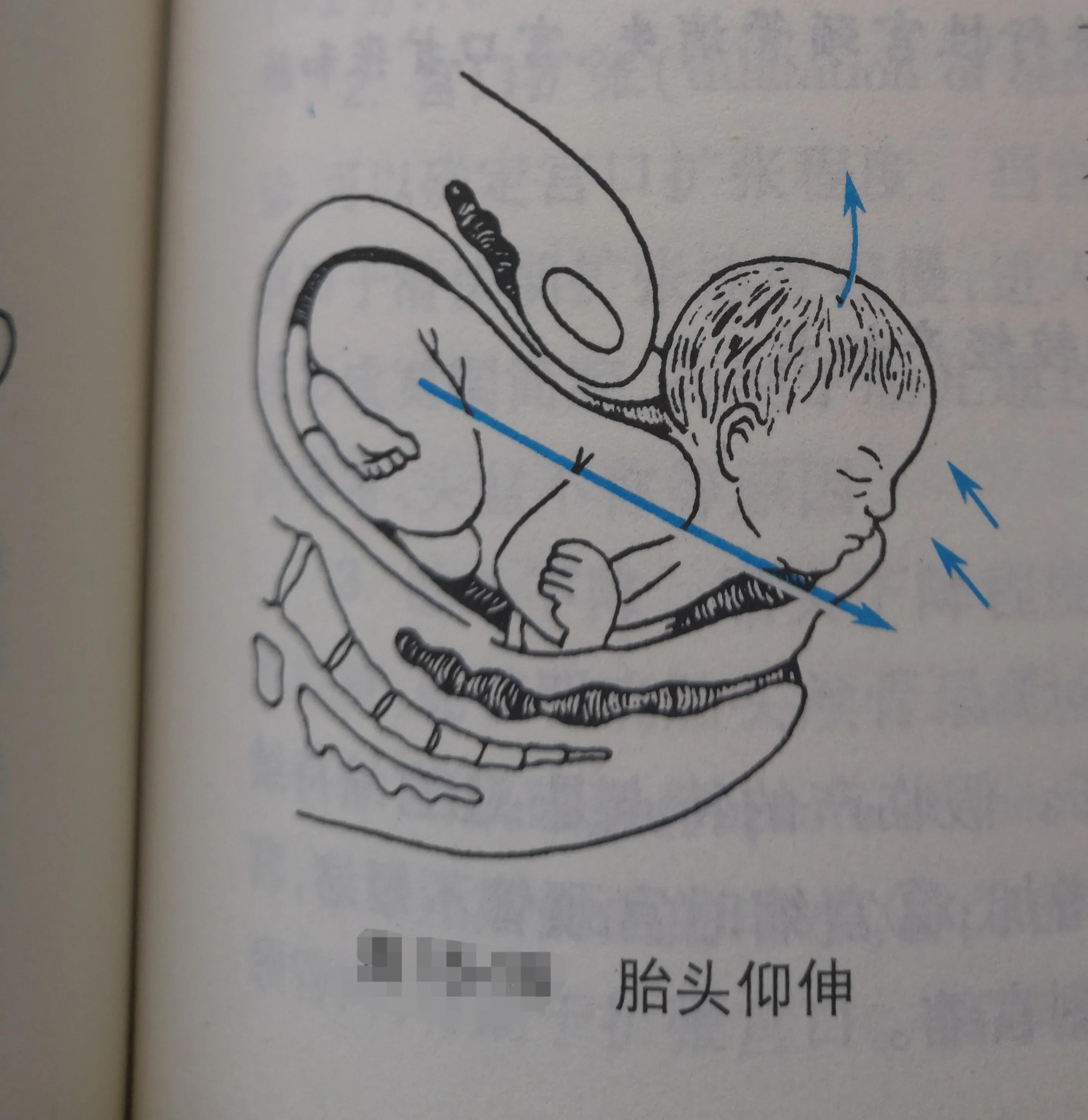 分娩基础知识,正常分娩胎儿的分娩机制