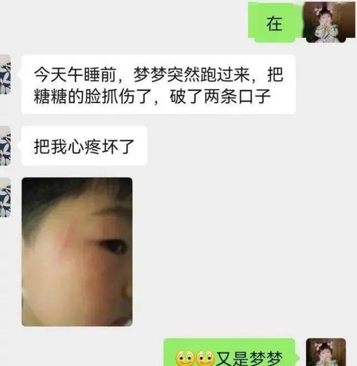 孩子在小学被别人抓了脸怎么处理,孩子脸被同学抓破家长怎么留证据