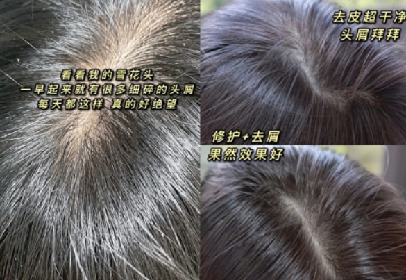 适合孕期使用的洗发水推荐,孕期适合使用的洗发水有啥牌子