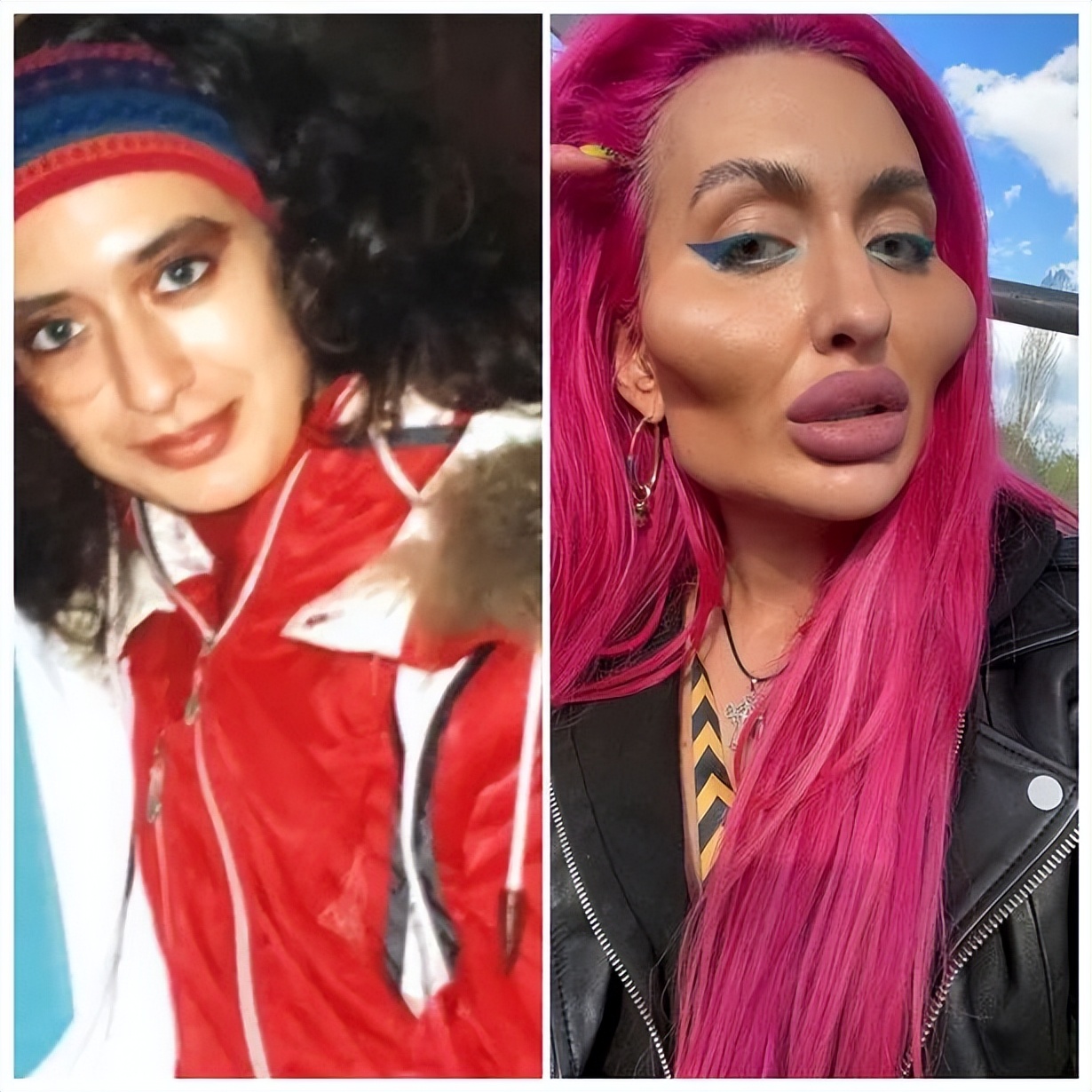 这个动手术打造世界最高颧骨的女人，再次向自己的颧骨下手了