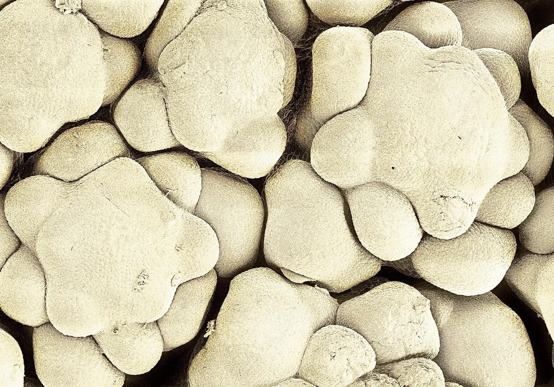 手指在显微镜下太恐怖了,显微镜下的恐怖世界蝎子