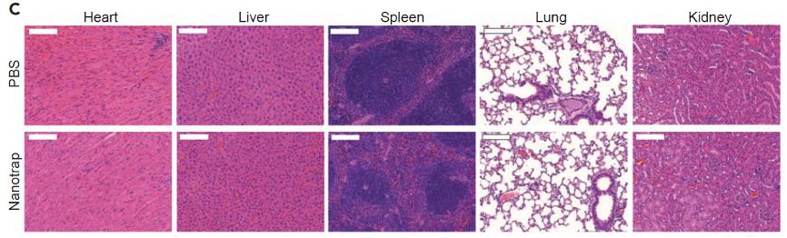 3i晶格光片显微镜助力新冠治疗纳米药物开发