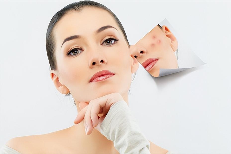 痘痘增生疤痕疙瘩怎么能彻底消除,如何分辨凸起的是痘痘还是疤痕