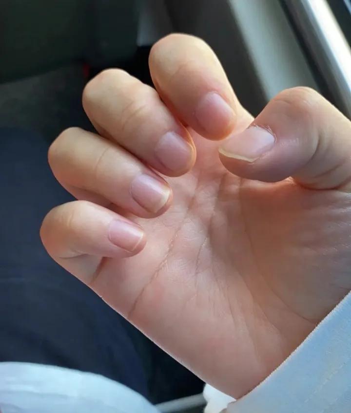 春节的这个节目是必备的，导致老吴指甲化脓感染，这个锅谁背？