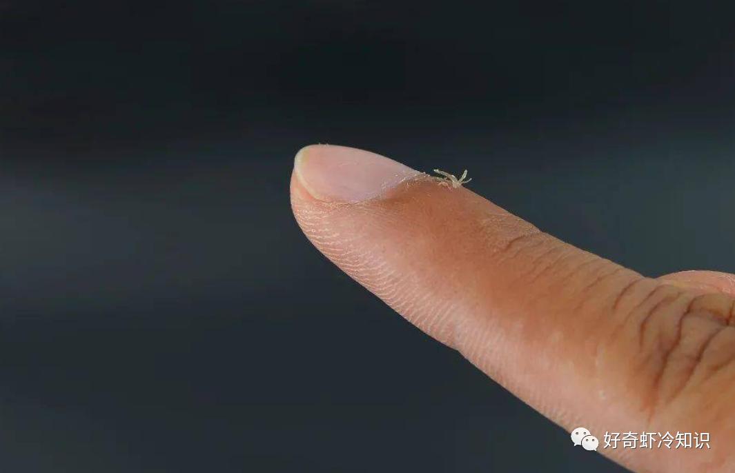 长了倒刺是什么病,长了倒刺怎么弄才不会疼