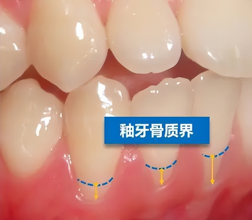 怎么拯救脱发小仙女,如何拯救牙齿上的黑洞