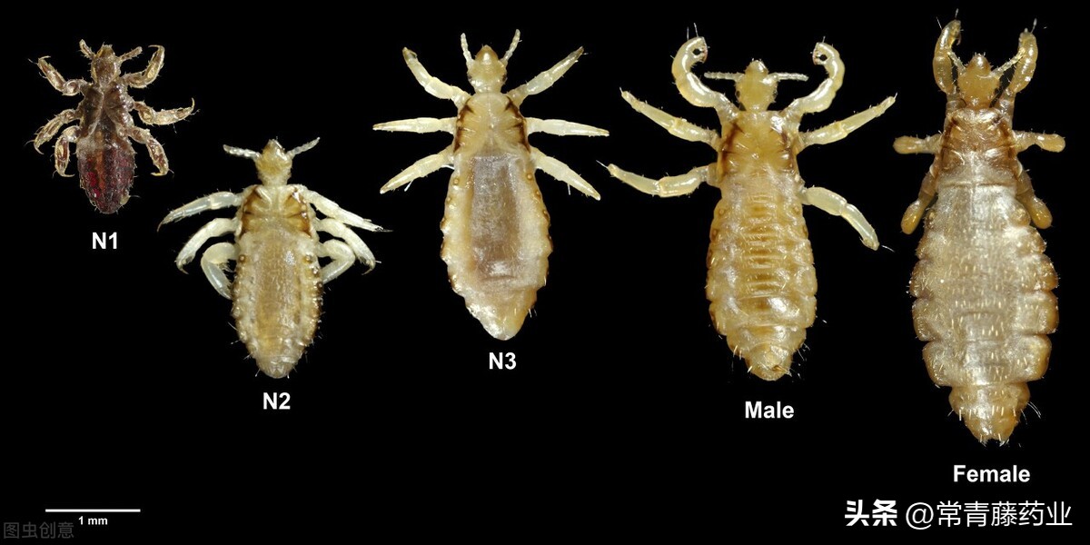 虱子与我们共存千万年，头上长虱子是啥感觉？有什么办法治疗？