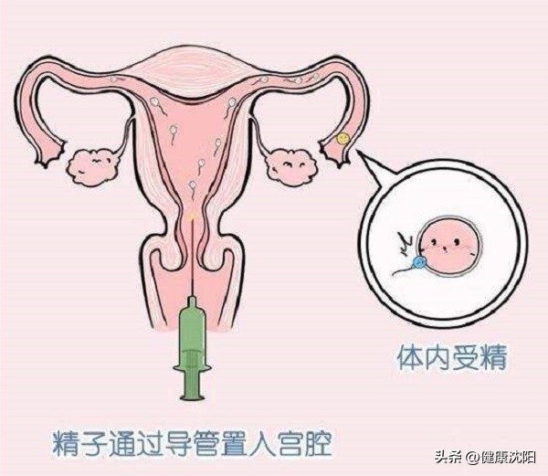 妇幼保健知识宣教活动方案,健康知识普及行动系列科普知识