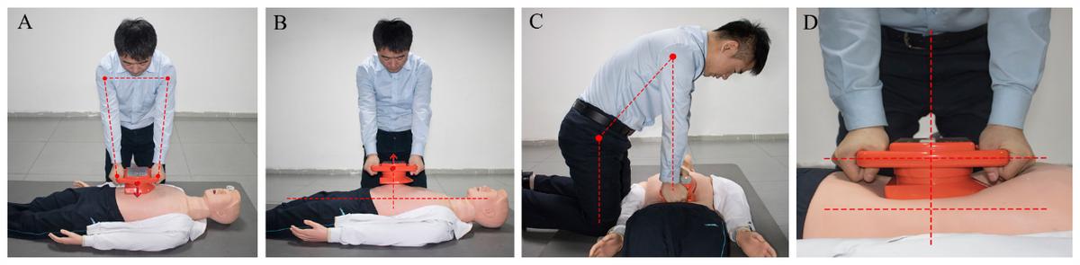 腹部提压心肺复苏术有用吗,腹部提压心肺复苏和胸外心脏按压