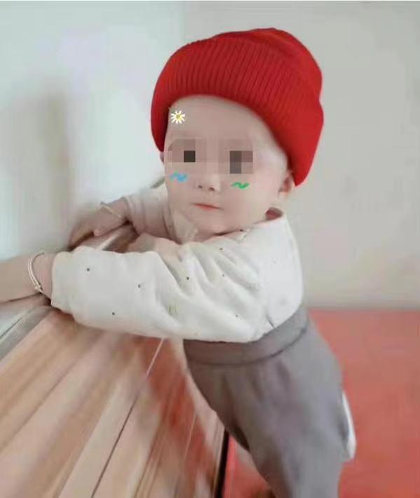 儿童急性喉炎预后,孩子急性喉炎导致死亡