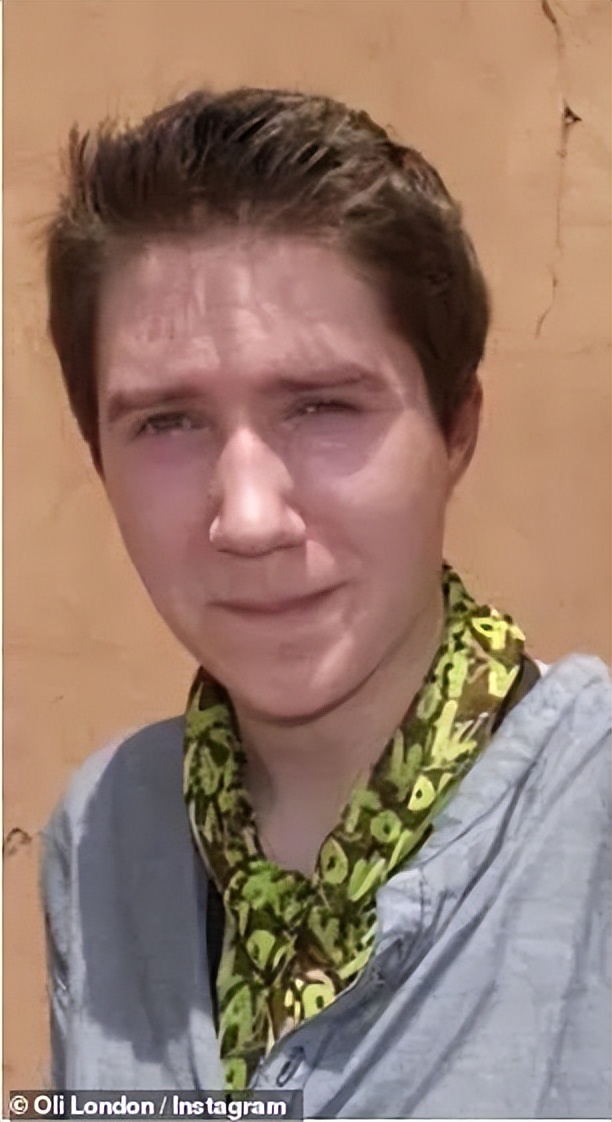 疯狂整容的网红,美国白人网红整成韩国人