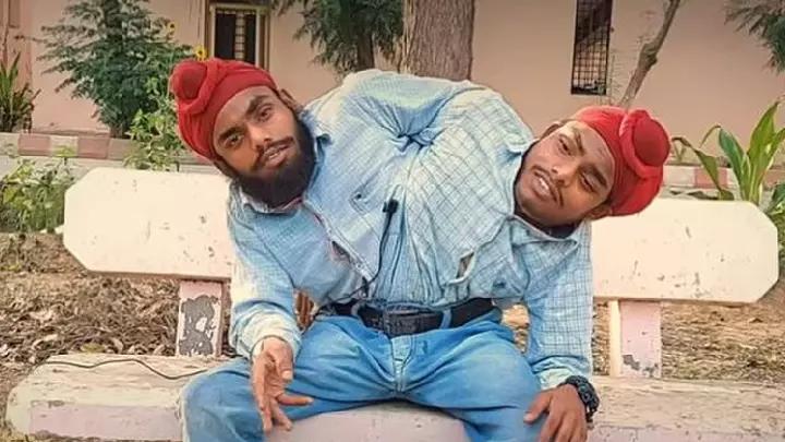 印度连体双胞胎兄弟,印度连体姐妹同嫁一个男人