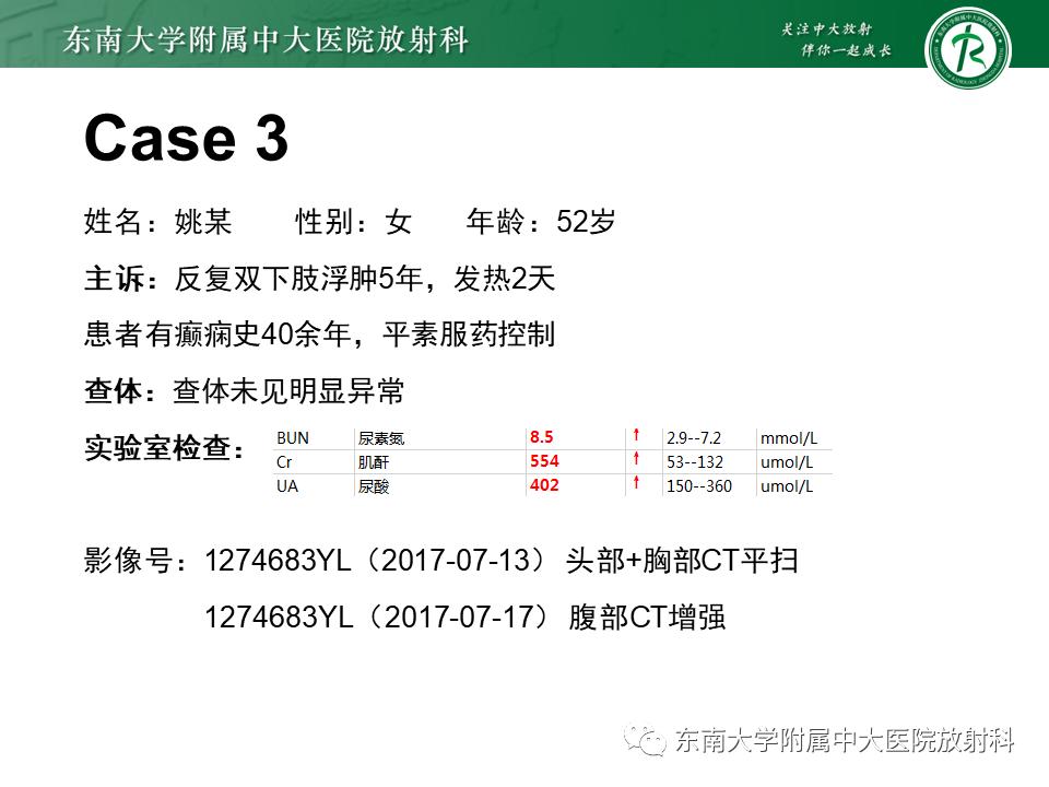 好文分享——《肾血管平滑肌脂肪瘤》