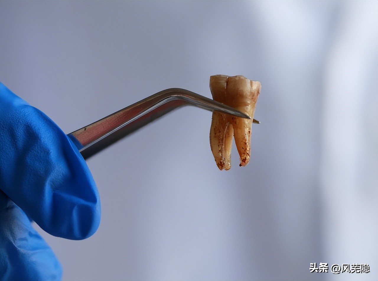 三甲专科医院专家靠谱吗？创口难受一年，原来手术线还在